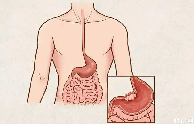 古代也有益生菌?古人消化不良怎么办?