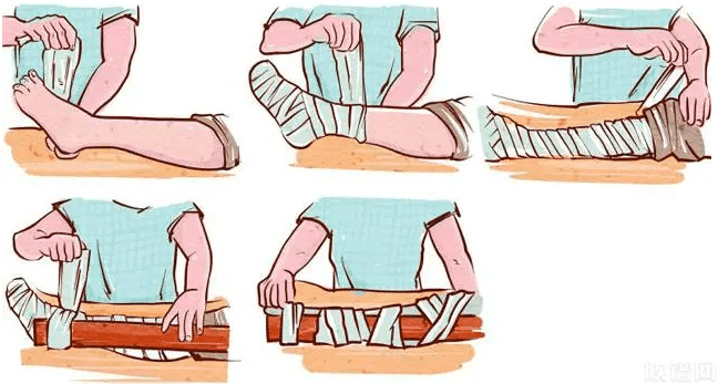 婴儿出生后颅骨骨折 医院回应,古代骨折了怎么办?