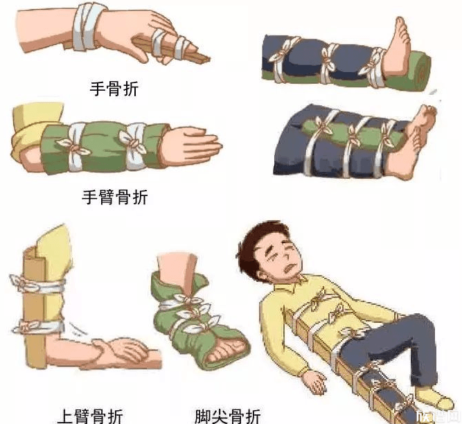 婴儿出生后颅骨骨折医院回应,古代骨折了怎么办?