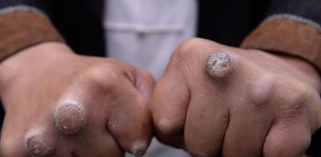 1514514615749130.jpg 1514514615749130.jpg